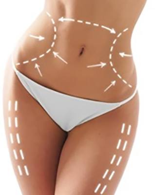 Up to 10% Off on Ultrasonic Fat Reduction at Body Contouring Miami